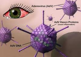 Bệnh do nhiễm Adenovirus