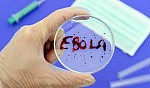 Bệnh sốt xuất huyết do virus Eblola, lassa, hoặc Marburg